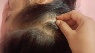 Scalp Check \u0026 ASMR Therapy: The Future of Self-Care