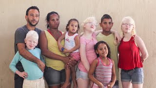 Zwarte Braziliaanse Moeder Bevalt Van 3 Witte Kinderen. De Reden Is Zeer Schokkend!
