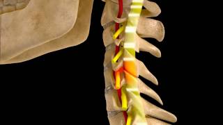 Cervical Vertebral Artery Compression