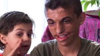 Video: Iraqi boy burned by masked men speaks out nine years later