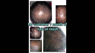 Are you searching pure natural 100% result herbal hair oil