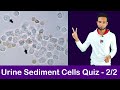 Urine Sediment Cell Identification Training Quiz - 2/2