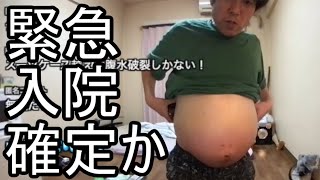 【金バエ】悲報 腹水が破裂する可能性について語る【肝不全 余命1年】 2024/02/16