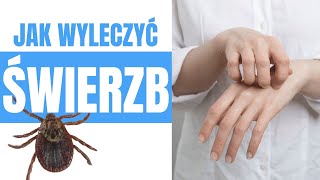 Jak wyleczyć świerzb? www.swierzb24.pl