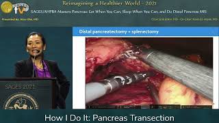 How I Do It: Pancreas Transection