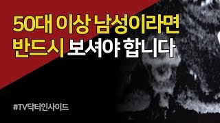 전립선암, 50대 이상 남성들은 꼭 보세요. [ 부산MBC TV닥터인사이드 20190930 ]