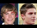Is Zac Efron's Face All Natural  Plastic Surgery Analysis