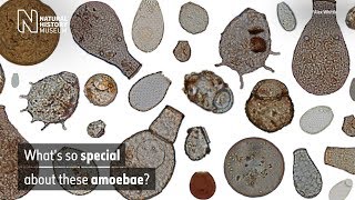 What's so special about these amoebae? | Natural History Museum