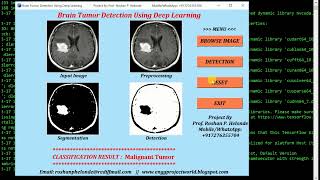Brain Tumor Classification Using Deep Learning Neural Network Python Project With Source Code