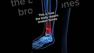 This is how your body heals a broken bone #facts #science #amazing #shorts