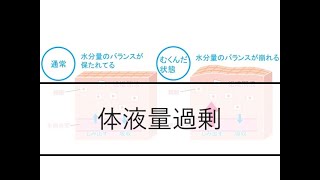 1分で見る標準看護計画！体液量過剰