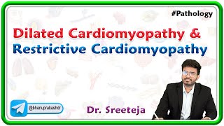 10: Dilated Cardiomyopathy and Restrictive Cardiomyopathy : Pathology USMLE Step 1