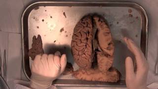 MIT Introduction to Neuroanatomy Series: Part 2