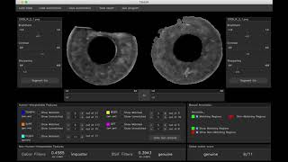 Iris Recognition Tool Demo