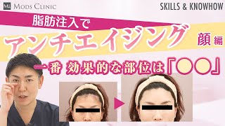 意外と知られていない顔の脂肪注入について／北條誠至 医師｜Mods Clinic（モッズクリニック）