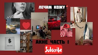 лечим кожу от акне |средства от прыщей | Часть 1📍#акне#skincare#обзоры#бьюти #бьютиобзор#бьютисоветы