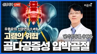 고령의 위협, 골다공증성 압박골절 (남기세병원 신경외과 우종윤) [우종윤의 신경 연구소]