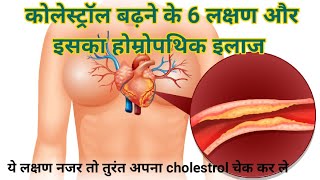 कोलेस्ट्रॉल बढ़ने के 6 लक्षण I होम्योपैथीक इलाज High Cholesterol #Cholesterol #HighCholesterol#khoon