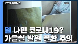 열 나면 코로나19? 가을철 발열성 감염 질환 주의 / YTN