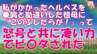 【スカッとする話 Ⅱ】【修羅場な話】私がかかったヘルペスを〇病と勘違いした祖母に「このふしだらが！」って怒号と共に凄い力でビ〇タされた（スカッとんCH）