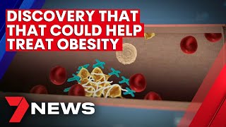 Melbourne scientists have made a discovery that could help treat obesity | 7NEWS