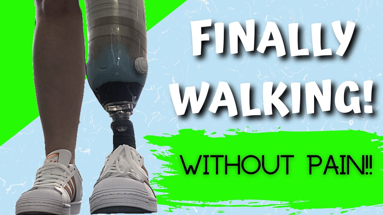 AMPUTEE WALKS FOR THE FIRST TIME On Prosthetic Leg After Elective ...