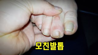 [귀촌귀농] 첫연탄,배 상처,모친발톱,아깽이 벌써 마운팅?