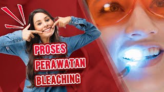 PROSES BLEACHING UNTUK MEMUTIHKAN GIGI