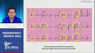 ENFERMEDADES PERICARDICAS: PERICARDITIS AGUDA, TUBERCULOSA Y CONSTRICTIVA