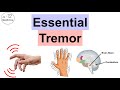 Essential Tremor | Causes, Pathophysiology, Symptoms, Exacerbating Factors, Diagnosis, Treatment