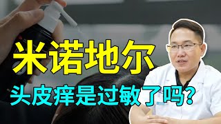 【脱发问答】什么情况？用了米诺地尔头皮痒是过敏了吗？雍禾植发|马晓阳医生