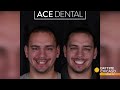 transform your smile in just 24 hours at ace dental