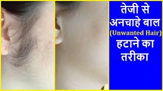 अनचाहे बालों से हमेशा हमेशा के लिए छुटकारा पाएं | Permanent Hair Removal at Home in Hindi