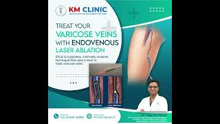 ENDOVENOUS LASER ABLATION FIR VARICOSE VEINS #shorts