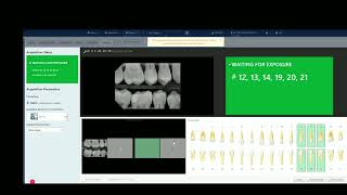 Dentrix Ascend— DC-Air™ Acquisition