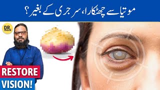Safed/Kala Motia Ka Ilaj, Bina Surgery! Treating Cataracts Without Surgery | Dr. Ibrahim
