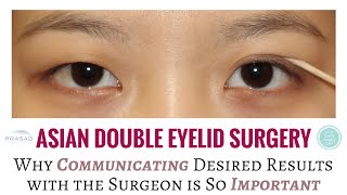 How Miscommunication of Expectations is a Common Cause of Needing Revision Double Eyelid Surgery