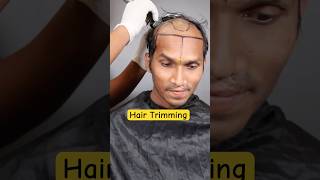 Hair trimming for surgery 🥺 | #ytshorts |#Youtubeshorts #hairtransplant #Shorts