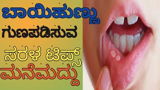 ಬಾಯಿಹುಣ್ಣಿಗೆ ಮನೆಮದ್ದು||simple home remedies for mouth ulcers!