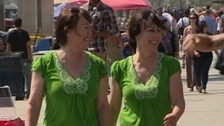 Identical Twins Undergo Plastic Surgery Together