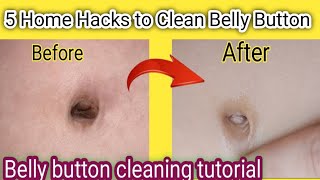 How to Clean Bellybutton Dirt At Home | Tips and Tricks | Kitchen \u0026 Hometips| Life Hacks