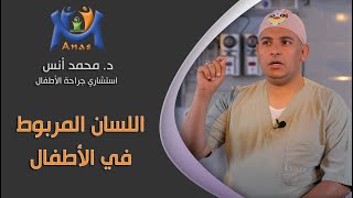 اللسان المربوط في الأطفال - دكتور محمد أنس