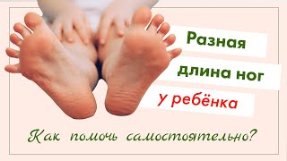 У РЕБЕНКА РАЗНАЯ ДЛИНА НОГ – ЧТО ДЕЛАТЬ