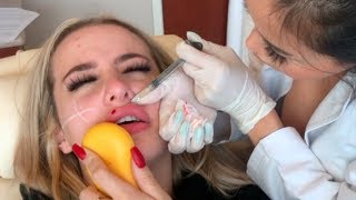 GET A FACE FULL OF FILLER WITH ME (graphic) (also fake)