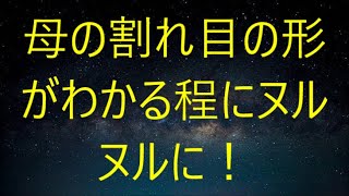 美人女医を事故から庇った俺、右手骨折で彼女から介抱され「あなたが右手でヤること全部私がヤりますね」...【朗読】