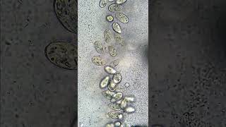 Half Your Cells Are Not Human #cells #bacteria #human #virus