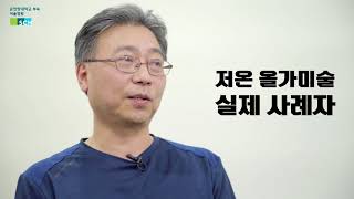 대장내시경 저온올가미 용종절제술