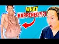 Plastic Surgeon Reacts to Man with 70 lbs Tumors of His Face! EXTREME Bodies Explained!