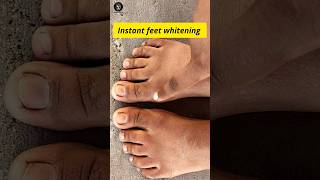 Instant feet whitening #shorts #beauty #skincare #beautytips #beautyhacks #remedies