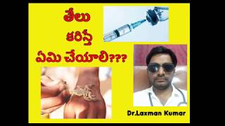 తేలు కాటు చికిత్స తెలుగు లో//Scorpio bite treatment in telugu// medication //Dr.Laxman sir tv